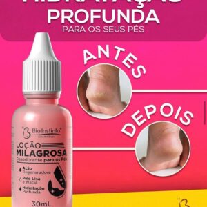 Loção Milagrosa (Desodorante Para Os Pés)30ml  BIO